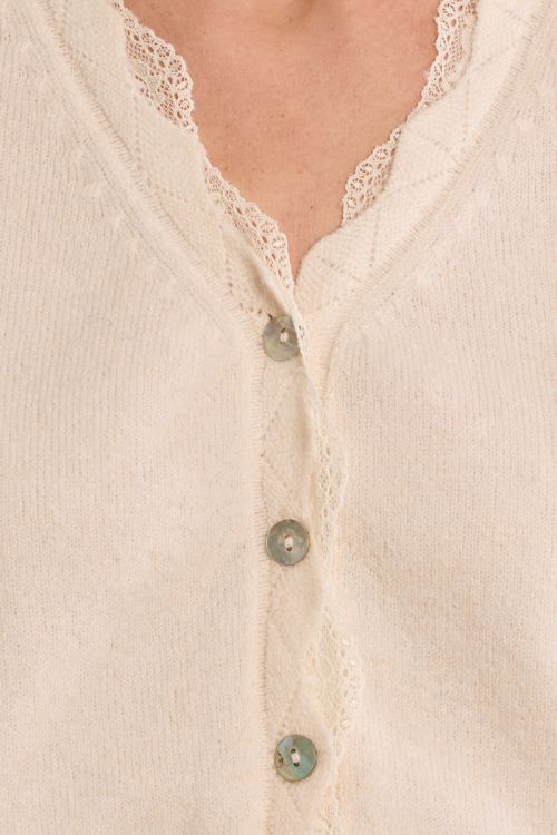 Lace scalloped cardigan
