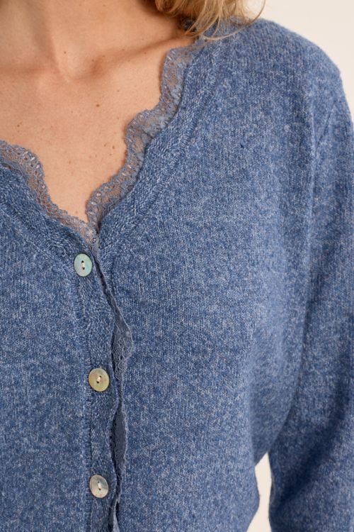 Lace scalloped cardigan